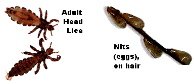 Lice and nits